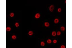 ABIN6266672 staining HeLa by IF/ICC. (USF2 抗体  (Internal Region))