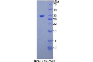 SDS-PAGE analysis of Mouse COL1a1 Protein. (COL1A1 蛋白)