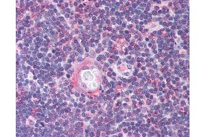 Anti-CDC25B antibody IHC of human thymus. (CDC25B 抗体  (AA 56-105))