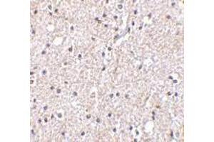 Immunohistochemistry of BRSK2 in human brain tissue with BRSK2 antibody at 5 μg/ml.