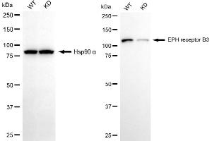 Western blotting analysis using EPH receptor B3 antibody (ABIN7798456). (Recombinant EPH Receptor B3 抗体)