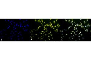 Immunocytochemistry/Immunofluorescence analysis using Rabbit Anti-Phosphothreonine Polyclonal Antibody (ABIN361757).