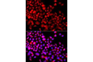 Immunofluorescence analysis of A549 cell using CALCOCO1 antibody. (CALCOCO1 抗体)