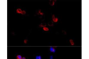 Immunofluorescence analysis of HeLa cells using FLNB Polyclonal Antibody at dilution of 1:100 (40x lens). (FLNB 抗体)