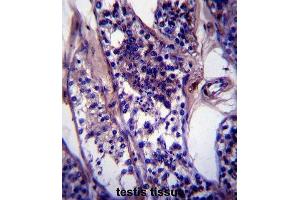 Immunohistochemistry (IHC) image for anti-Coiled-Coil Domain Containing 99 (CCDC99) antibody (ABIN2997362) (CCDC99 抗体)