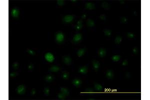 Immunofluorescence of monoclonal antibody to HNRPA2B1 on HeLa cell. (HNRNPA2B1 抗体  (AA 1-249))