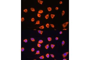 Immunofluorescence analysis of L929 cells using SCYL2 Rabbit pAb (ABIN6132636, ABIN6147463, ABIN6147465 and ABIN6217078) at dilution of 1:100. (SCYL2 抗体  (AA 1-300))