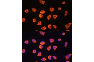 Immunofluorescence analysis of L929 cells using SCYL2 Rabbit pAb (ABIN6132636, ABIN6147463, ABIN6147465 and ABIN6217078) at dilution of 1:100.
