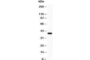 Western blot testing of IKK alpha antibody and recombinant human protein (0. (IKK alpha 抗体  (AA 411-745))