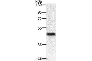 Western blot analysis of Mouse heart tissue, using PDK2 Polyclonal Antibody at dilution of 1:500 (PDK2 抗体)