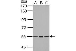 Western Blotting (WB) image for anti-Cytochrome P450, Family 4, Subfamily B, Polypeptide 1 (CYP4B1) (Center) antibody (ABIN2855476)