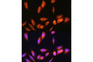 Immunofluorescence analysis of U2OS cells using SCYL2 Rabbit pAb (ABIN6132636, ABIN6147463, ABIN6147465 and ABIN6217078) at dilution of 1:100. (SCYL2 抗体  (AA 1-300))