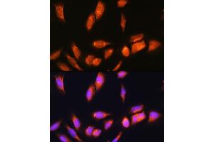 Immunofluorescence analysis of U2OS cells using SCYL2 Rabbit pAb (ABIN6132636, ABIN6147463, ABIN6147465 and ABIN6217078) at dilution of 1:100.