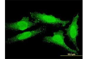 Immunofluorescence of monoclonal antibody to FOXO1 on HeLa cell. (FOXO1 抗体  (AA 556-655))