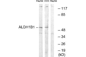 Western blot analysis of extracts from HepG2 cells and COS cells, using ALDH1B1 antibody. (ALDH1B1 抗体)
