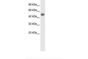 Image no. 3 for anti-Glial Cells Missing Homolog 1 (GCM1) (N-Term) antibody (ABIN6735857) (GCM1 抗体  (N-Term))