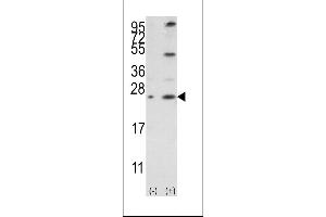 Western blot analysis of Bcl-w3 using rabbit polyclonal Bcl-w BH3 Domain Antibody using 293 cell lysates (2 ug/lane) either nontransfected (Lane 1) or transiently transfected with the BCL2L2 gene (Lane 2). (BCL2L2 抗体  (AA 24-59))