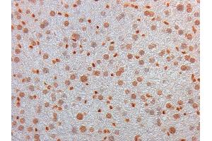 Immunohistochemistry of Mouse Monoclonal anti AKT3 Antibody in Mouse Embryonic Kidney Tissue: Mouse Liver Fixation: FFPE buffered formalin 10% conc Ag Retrieval: Heat, Citrate pH 6. (AKT3 抗体  (Internal Region))