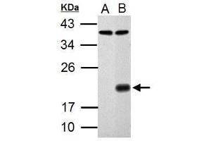 WB Image Sample (30 ug of whole cell lysate) A: HCT116 B: HCT116 treated with 30uM cisplatin for 24hr 12% SDS PAGE antibody diluted at 1:1000 (p21 抗体)