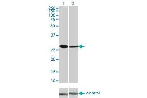 Western blot analysis of CDK4 over-expressed 293 cell line, cotransfected with CDK4 Validated Chimera RNAi (Lane 2) or non-transfected control (Lane 1). (CDK4 抗体  (AA 211-303))