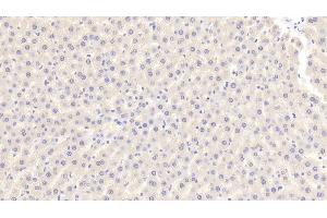 Detection of F2 in Rat Liver Tissue using Polyclonal Antibody to Coagulation Factor II (F2) (Prothrombin 抗体  (AA 44-200))