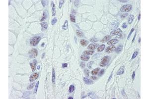 Immunohistochemistry (IHC) image for anti-Cyclin-Dependent Kinase 11B (CDK11B) (C-Term) antibody (ABIN7448470) (CDK11 抗体  (C-Term))