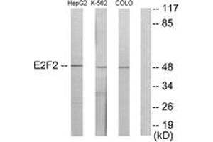 Western blot analysis of extracts from HepG2/K562/COLO205 cells, using E2F2 Antibody. (E2F2 抗体  (AA 221-270))