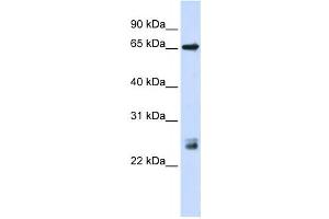 Western Blotting (WB) image for anti-Tripartite Motif Containing 8 (TRIM8) antibody (ABIN2458426) (TRIM8 抗体)