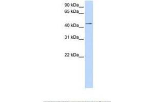 Image no. 1 for anti-Sulfotransferase Family, Cytosolic, 2B, Member 1 (SULT2B1) (AA 144-193) antibody (ABIN6738483)
