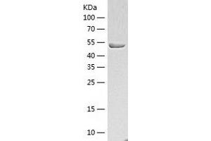 HARS1/Jo-1 Protein (AA 1-509) (His tag)