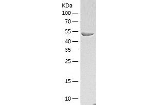 HARS1/Jo-1 Protein (AA 1-509) (His tag)