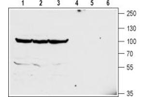 Western blot analysis of mouse brain (lanes 1 and 4), rat brain (lanes 2 and 5) and rat cerebellum (lanes 3 and 6) lysates:1-3.