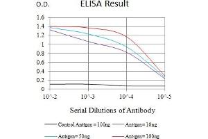 Black line: Control Antigen (100 ng),Purple line: Antigen (10 ng), Blue line: Antigen (50 ng), Red line:Antigen (100 ng) (IL7R 抗体  (AA 21-239))