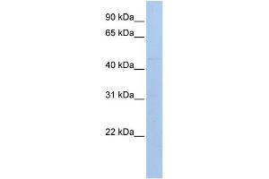 WB Suggested Anti-MAB21L1 Antibody Titration: 0. (MAB21L1 抗体  (N-Term))
