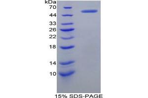 SDS-PAGE analysis of Human Complement Receptor 2 Protein.