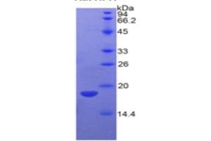 WB of Protein Standard: different control antibodies  against Highly purified E. (Hemopexin ELISA 试剂盒)