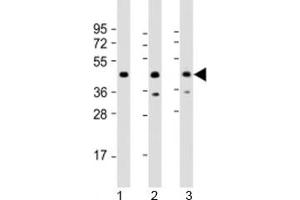 Western blot testing of human 1) 293T/17, 2) Jurkat and 3) K562 cell lysate with PHF6 antibody at 1:2000. (PHF6 抗体  (AA 148-180))