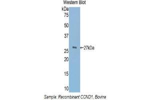 Western Blotting (WB) image for anti-Cyclin D1 (CCND1) (AA 72-272) antibody (ABIN3208329) (Cyclin D1 抗体  (AA 72-272))