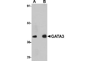 Western Blotting (WB) image for anti-GATA Binding Protein 3 (GATA3) (C-Term) antibody (ABIN1030408) (GATA3 抗体  (C-Term))