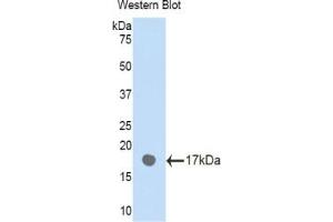 Detection of Recombinant PLXNB1, Human using Polyclonal Antibody to Plexin B1 (PLXNB1) (PLXNB1 抗体  (AA 47-126))