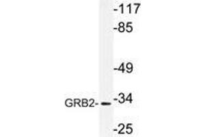 Western blot (WB) analysis of GRB2 antibody in extracts from Jurkat cells. (GRB2 抗体)