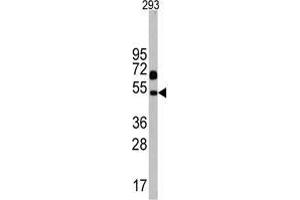Western blot analysis of Nptx1 Antibody (C-term) in 293 cell line lysates (35 µg/lane). (NPX1 抗体  (C-Term))