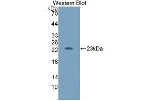 Detection of Recombinant HEXb, Human using Polyclonal Antibody to Hexosaminidase B Beta (HEXb) (HEXB 抗体  (AA 122-311))