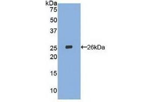 Western blot analysis of recombinant Human LOX1. (OLR1 抗体  (AA 81-273))
