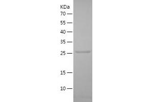 PTPRN Protein (AA 107-332) (His tag)