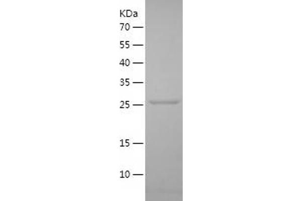 PTPRN Protein (AA 107-332) (His tag)