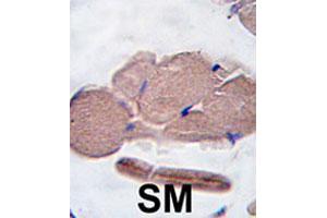 Formalin-fixed and paraffin-embedded human skeletal muscle tissue reacted with MSTN polyclonal antibody  , which was peroxidase-conjugated to the secondary antibody, followed by DAB staining. (MSTN 抗体  (AA 17-46))