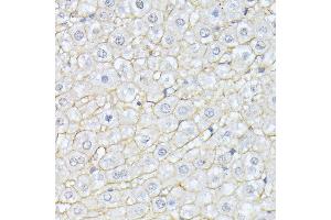 Immunohistochemistry of paraffin-embedded rat liver using Alpha Fodrin antibody (ABIN6128747, ABIN6148403, ABIN6148404 and ABIN6213643) at dilution of 1:100 (40x lens). (SPTAN1 抗体  (AA 950-1130))