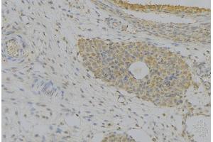 ABIN6277388 at 1/100 staining Human uterus tissue by IHC-P. (IGFBP7 抗体  (Internal Region))