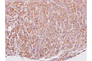 Immunohistochemistry (IHC) image for anti-C-Fos Induced Growth Factor (Vascular Endothelial Growth Factor D) (Figf) antibody (ABIN2854869)